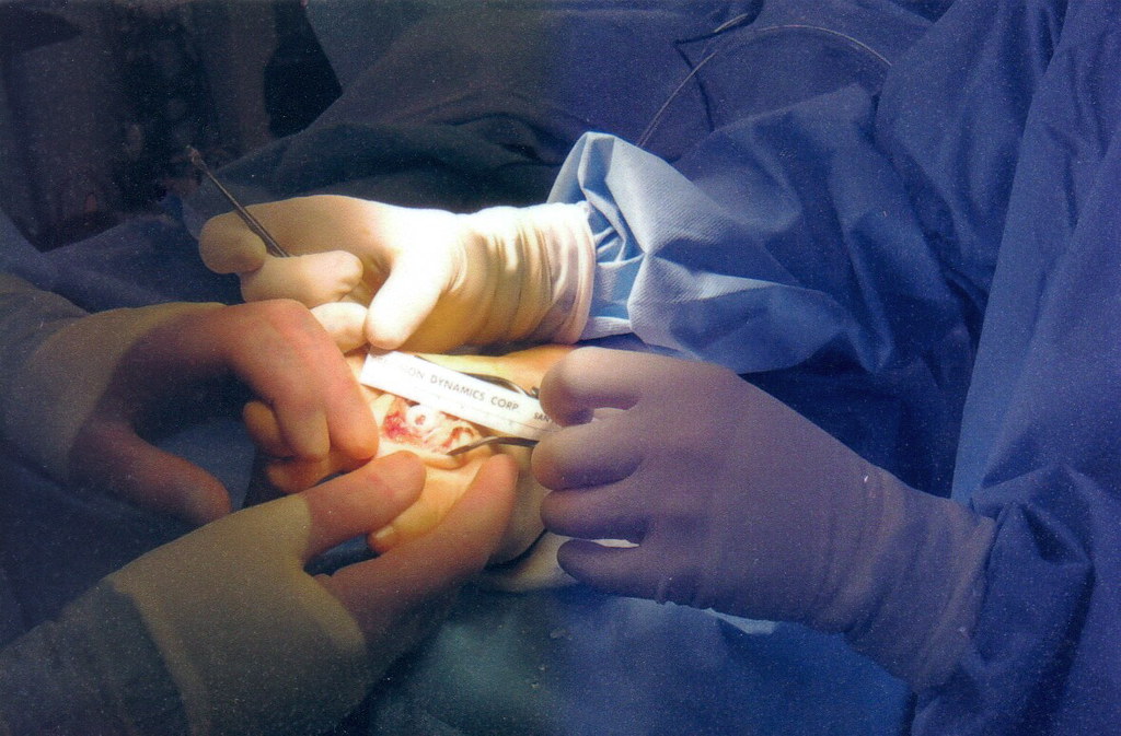 Arthritis Gloves: Do They Really Help Your Hands?