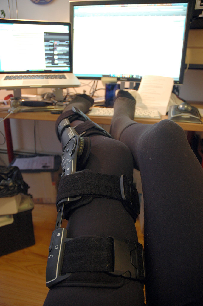 Knee Arthritis: Exercises to Manage the Pain